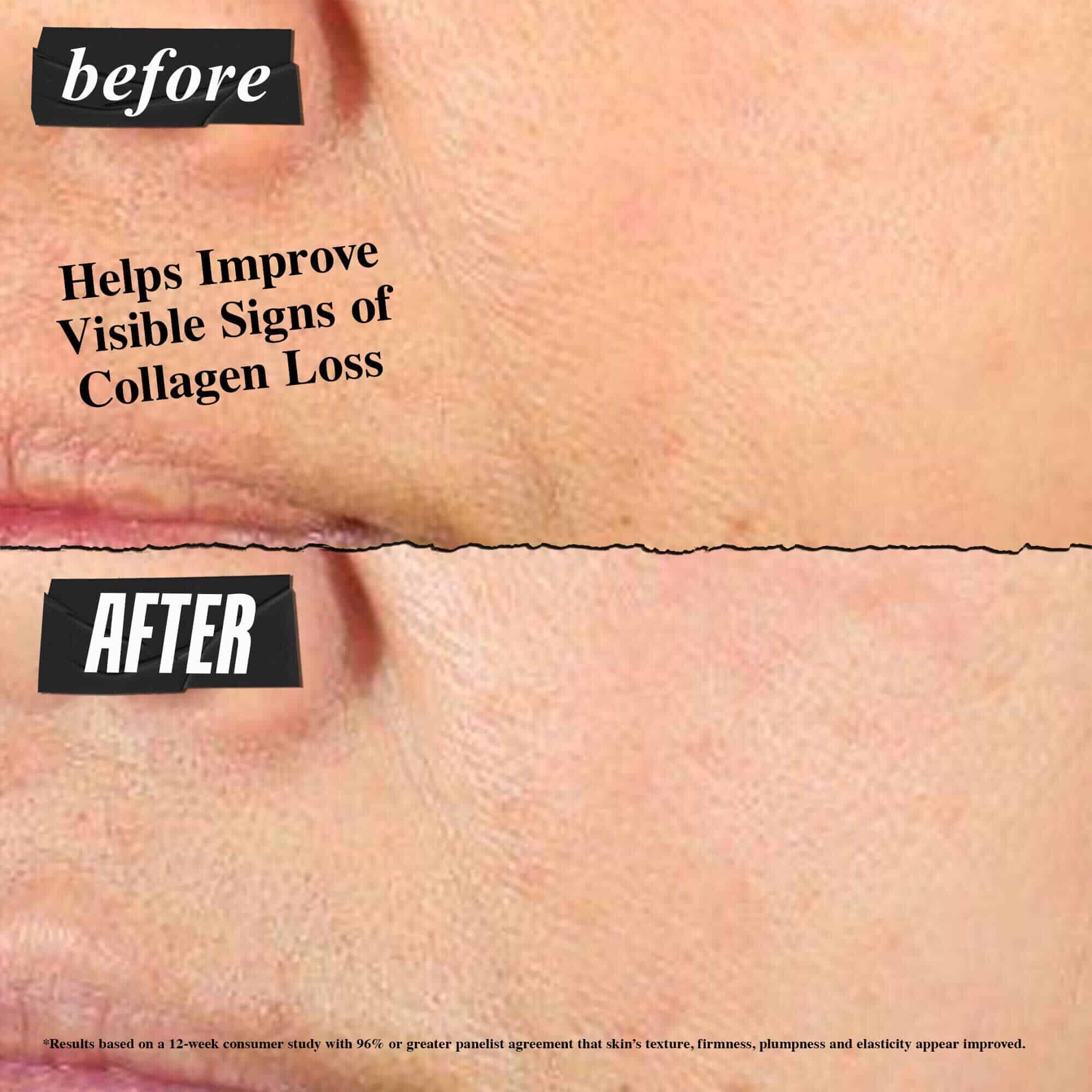 Foto de antes и despues: Kiehl's Super Multi-Corrective Cream ayuda a mejorar los signos visibles de la perdida de colageno