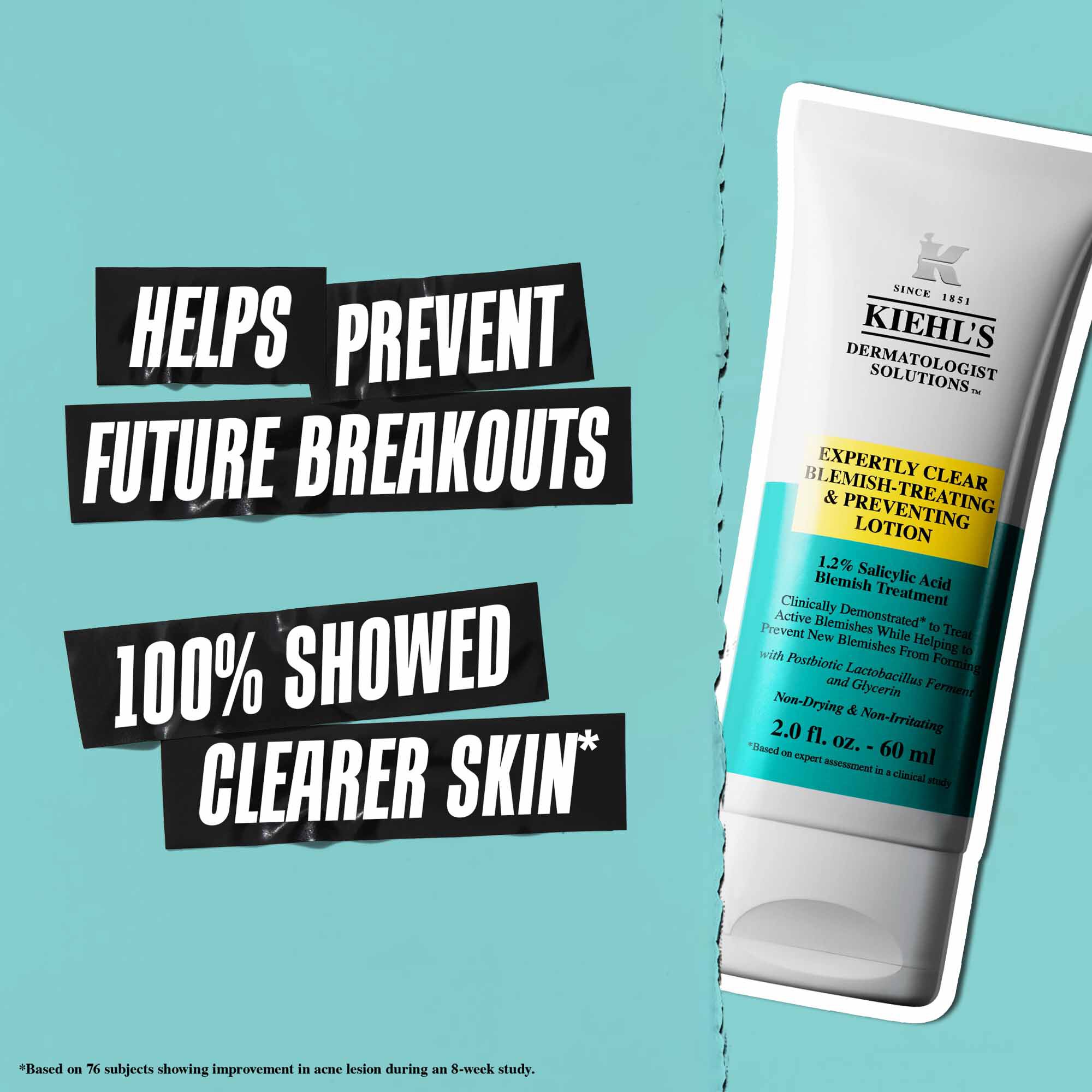 Un tubo de Expertly Clear Blemish-Treating & Preventing Lotion sobre fondo azul con el texto: "Ayuda a prevenir futuros brotes" y "El 100% mostro una piel mas clara".