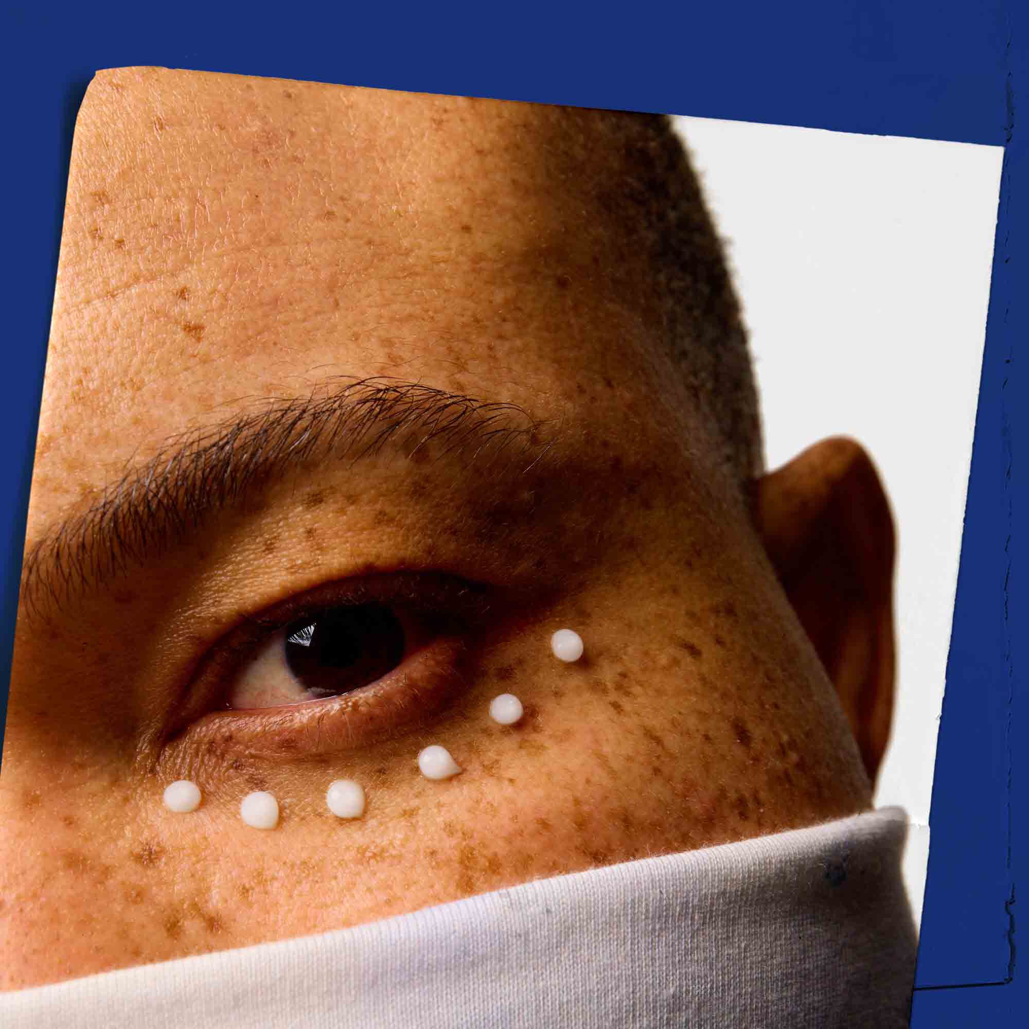 Primer plano de la piel alrededor del contorno de ojos con puntos de Facial Fuel Eye Fuel.