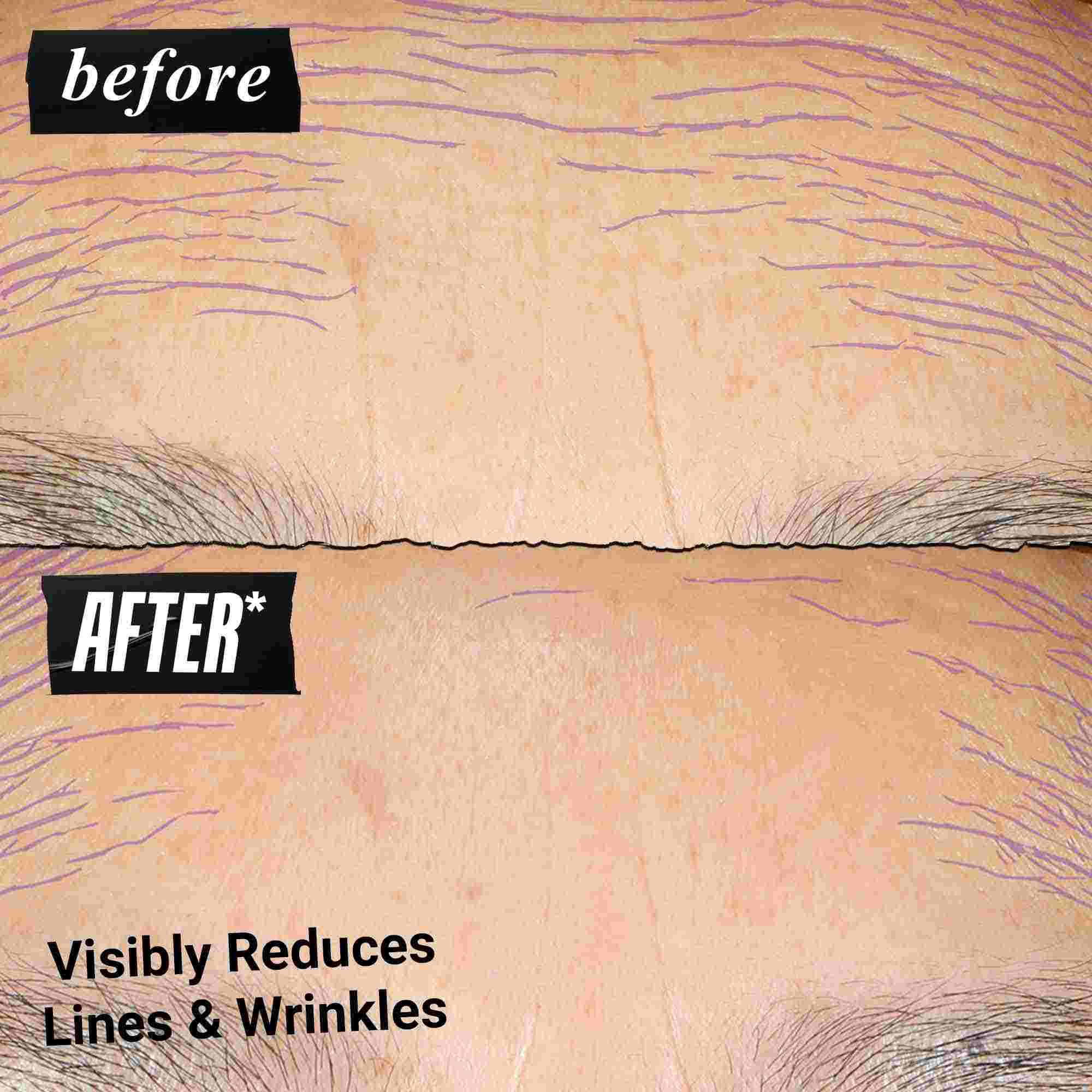 Foto de antes y despues: Kiehl's Retinol Skin Renewing Daily Microdose ayuda a mejorar el tono y la textura