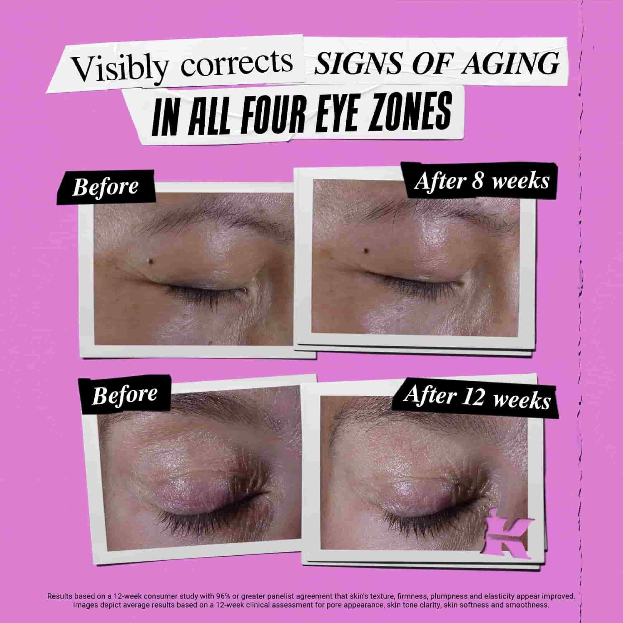 Foto de antes y despues de Kiehl's Super Multi-Corrective Eye Zone Treatment corrigiendo los signos de la edad