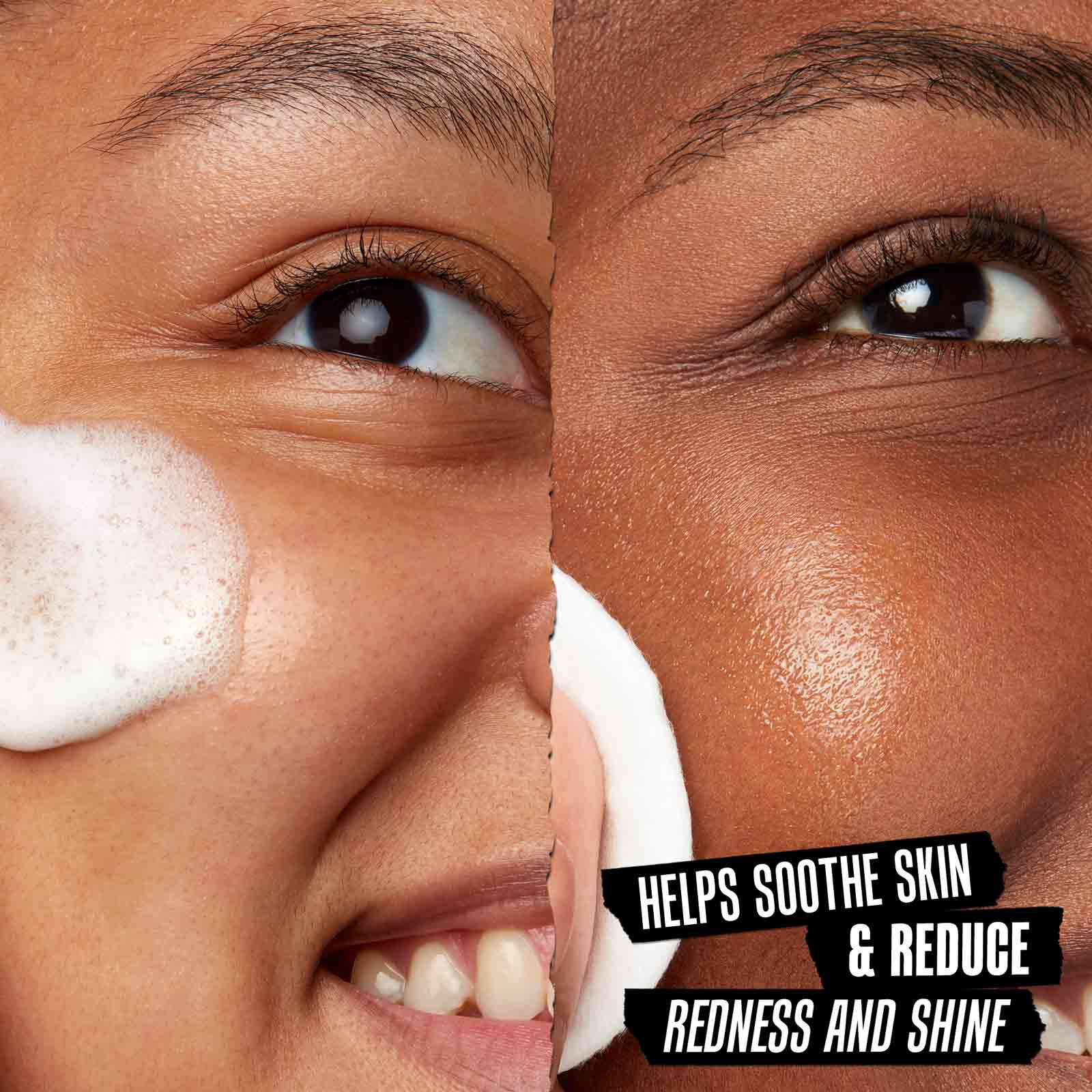 Model applying Kiehl's formulas to their face - Helps Soothe Skin & Reduce Redness and Shine