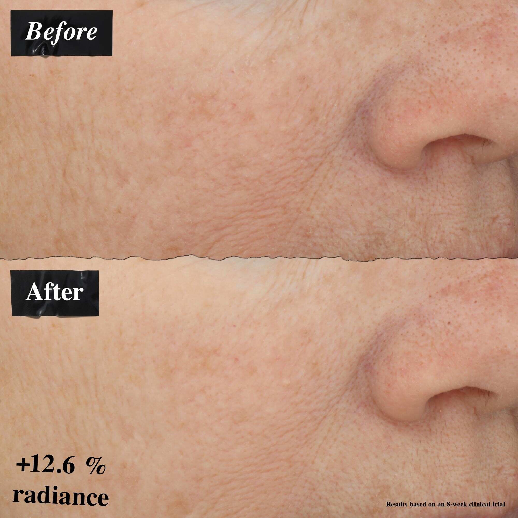 Una comparacion de imagenes de antes y despues que muestra una mejora en el enrojecimiento de la piel tras usar Powerful-Strength Line-Reducing Concentrate.