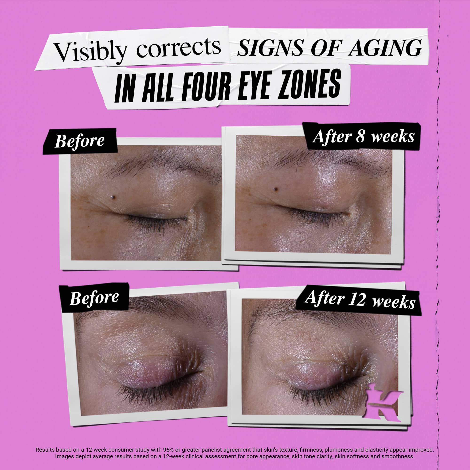 Foto de antes y despues de Kiehl's Super Multi-Corrective Eye Zone Treatment corrigiendo los signos de la edad