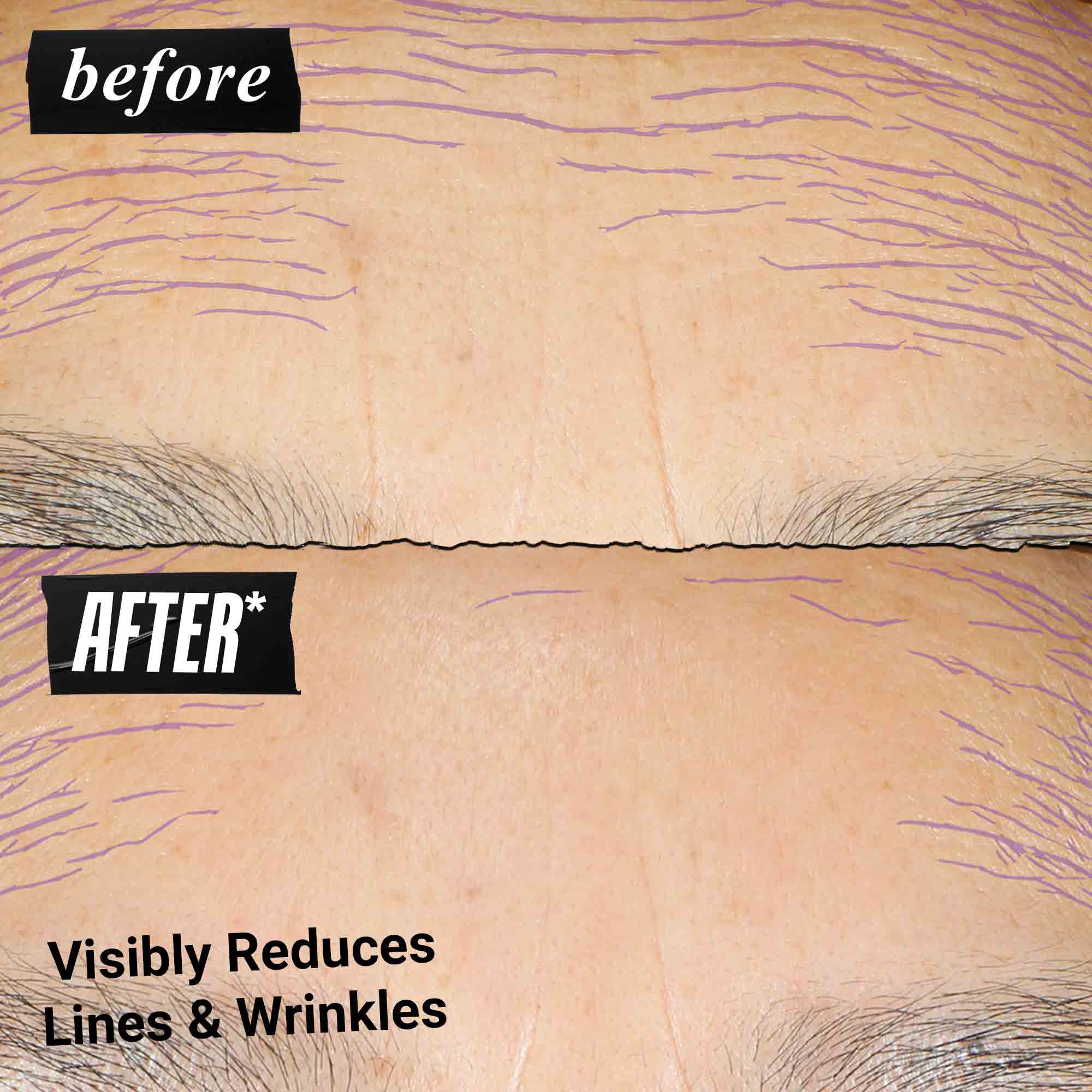 Foto de antes y despues: Kiehl's Retinol Skin Renewing Daily Microdose ayuda a mejorar el tono y la textura