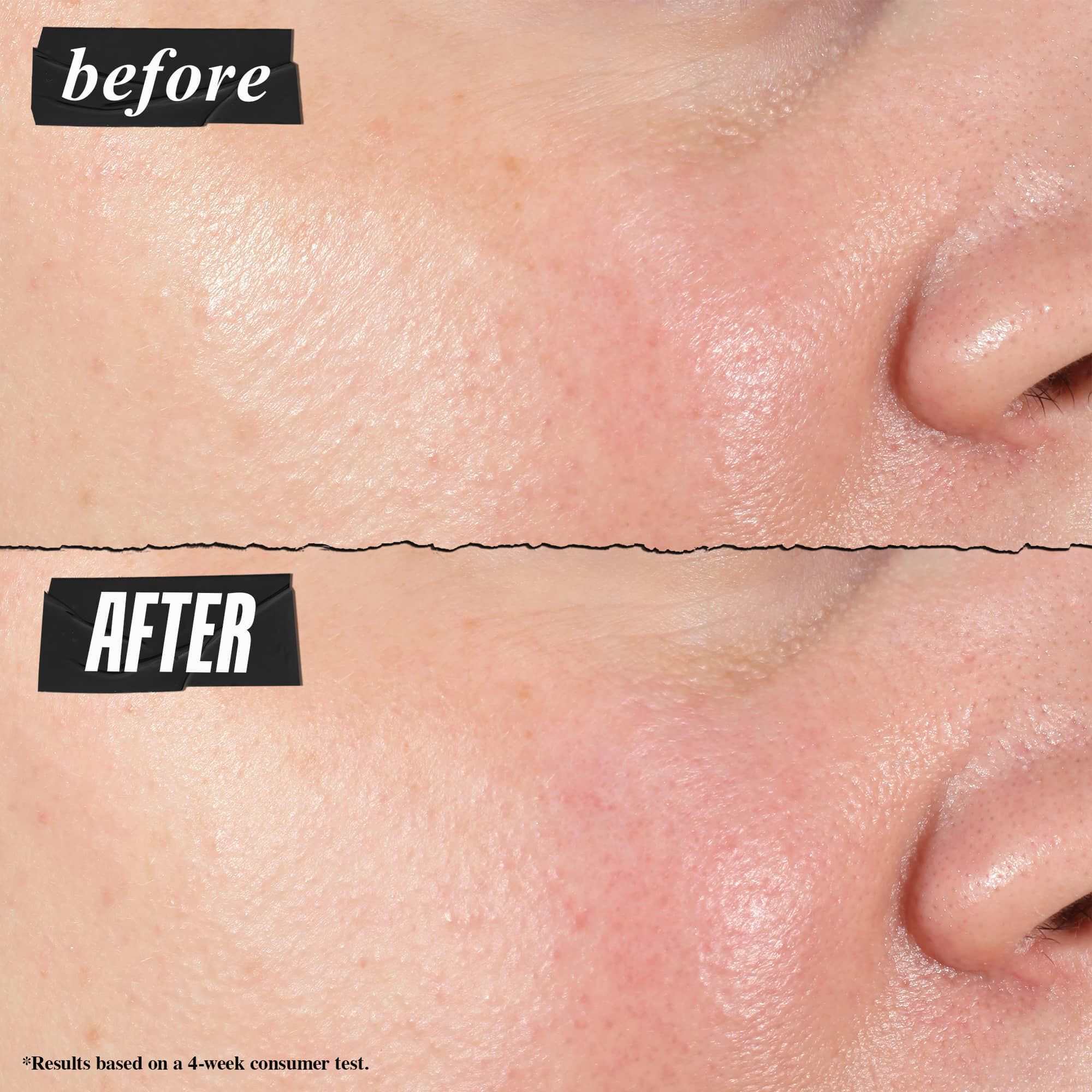 Foto de antes и despues: Kiehl's Hydro Plumping Serum Concentrate reduce los poros visiblemente