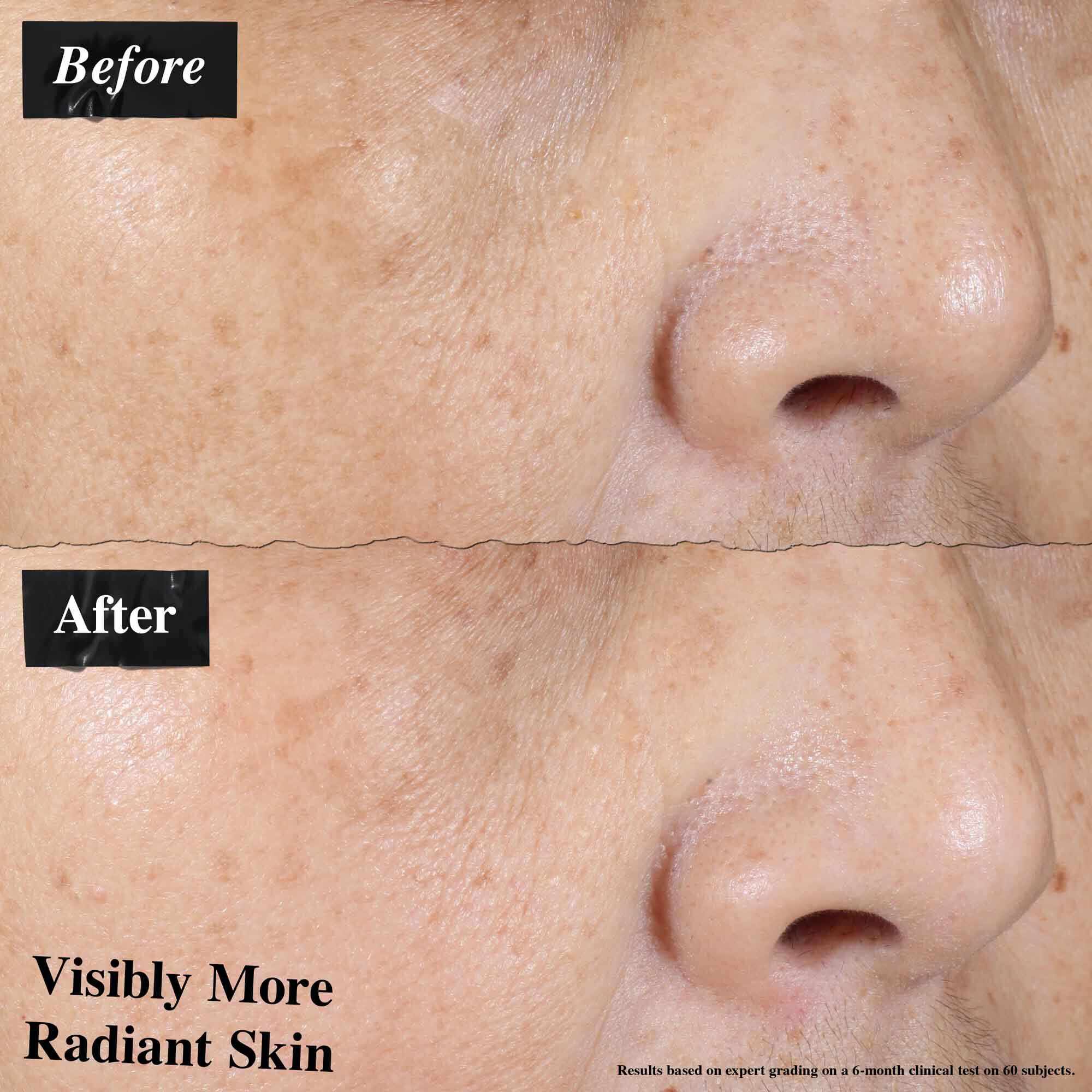 Comparacion de antes y despues que muestra una reduccion visible del enrojecimiento de la piel tras usar Ultra-Light Daily UV Defense.