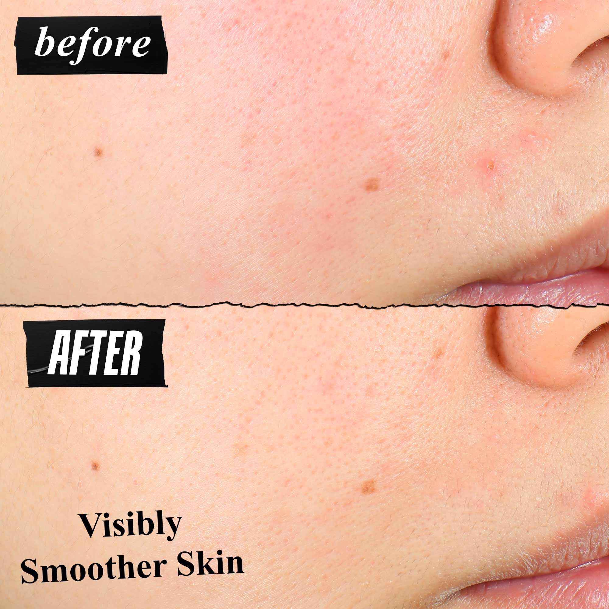 Una comparacion de antes y despues de la textura de la piel que muestra una piel visiblemente mas suave tras el uso.