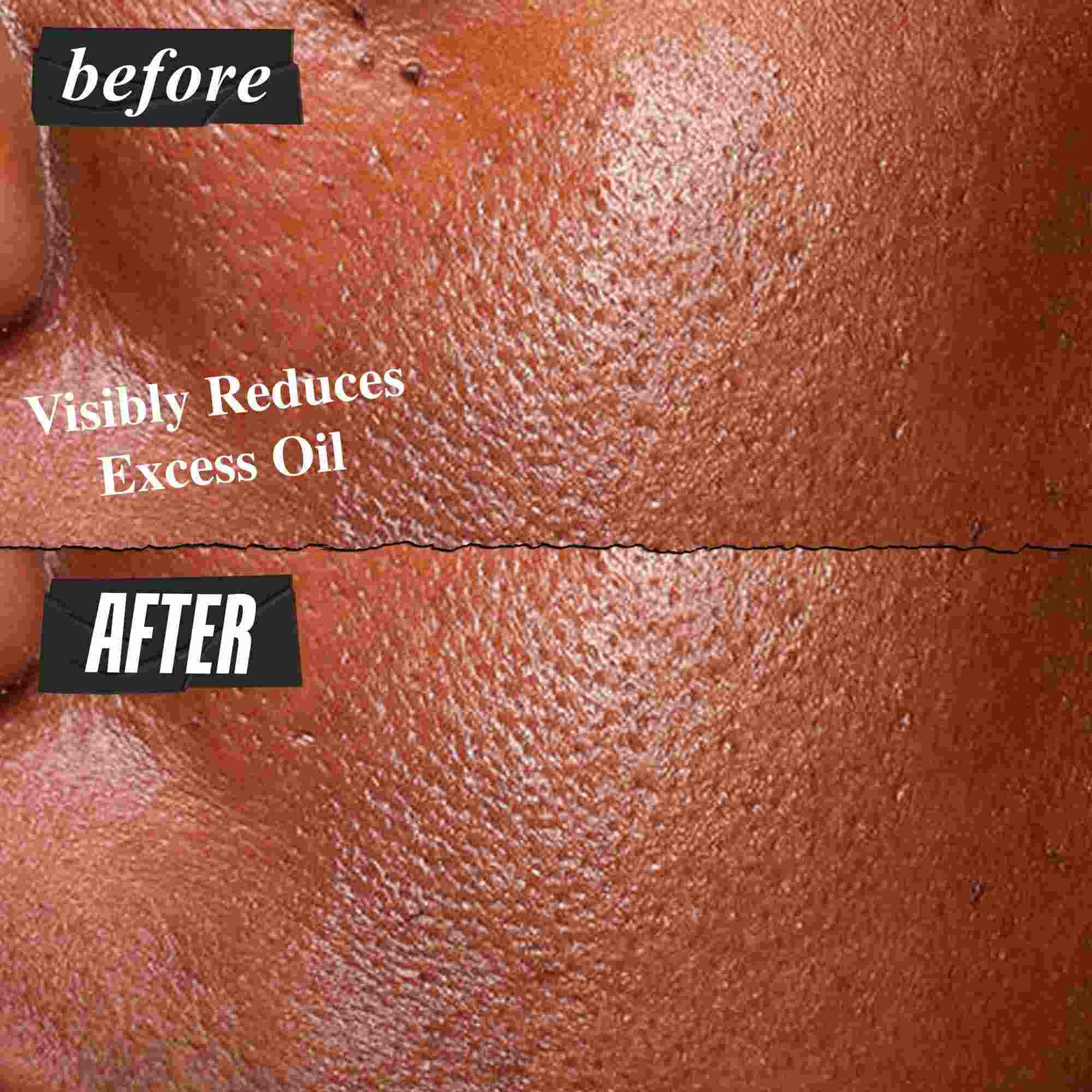 Foto de antes и despues de Kiehl's Ultra Pure High-Potency Serum reduciendo visiblemente el exceso de grasa