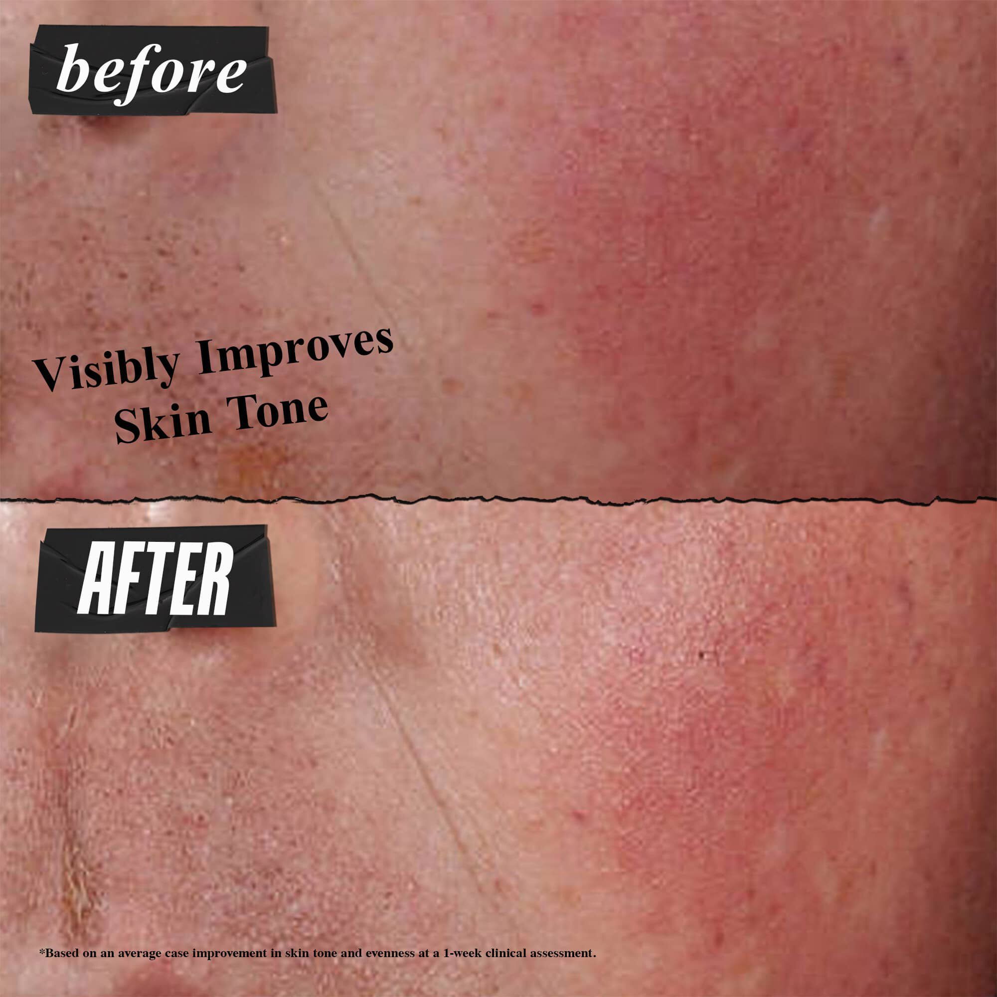 Foto de antes и despues: Kiehl's Ultra Facial Barrier Cream mejora visiblemente el tono de la piel