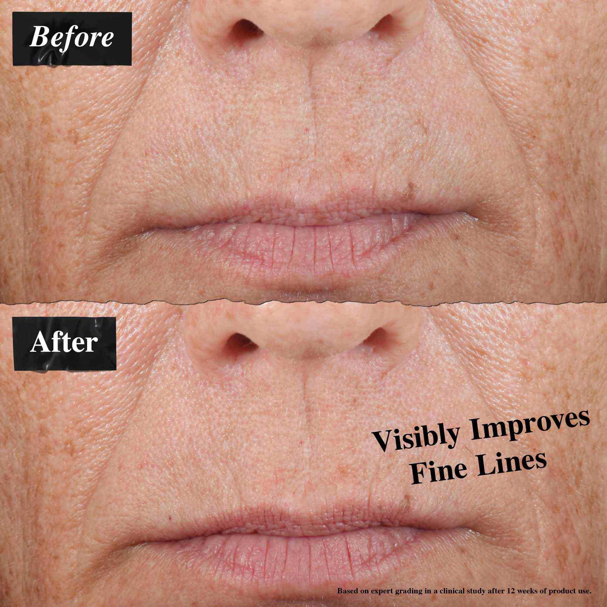 Una comparacion de antes y despues que muestra lineas de expresion visiblemente reducidas tras usar el aceite facial Midnight Recovery Concentrate.