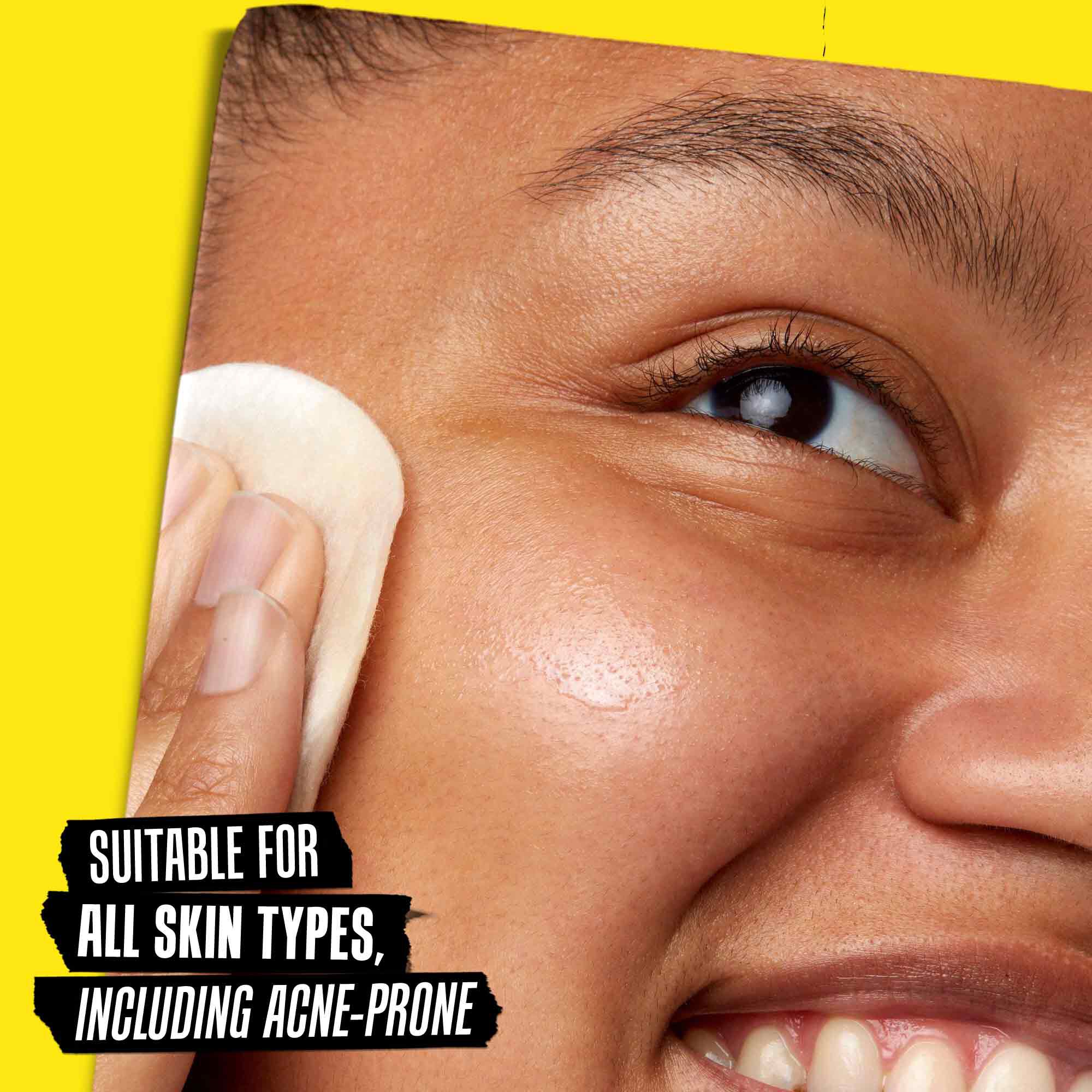  Model applying Calendula Herbal-Extract Toner: Suitable for All Skin Types, Including Acne-Prone 