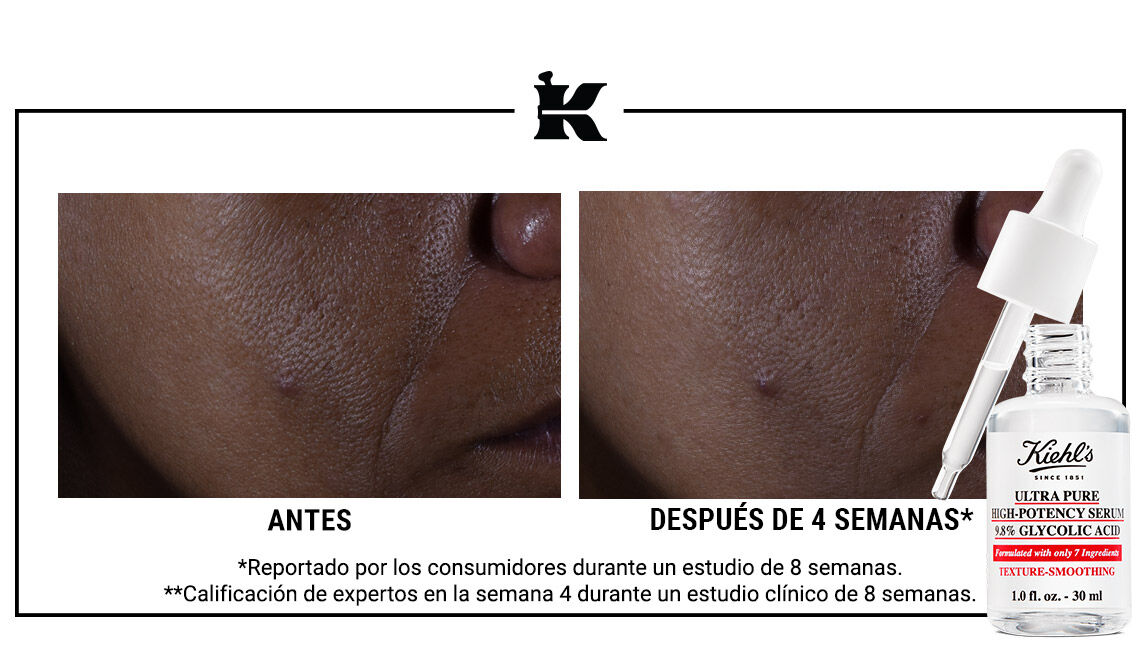 Serum Ácido Glicólico Ultra Pure High Potency, acido glicolico - Vimarsana News