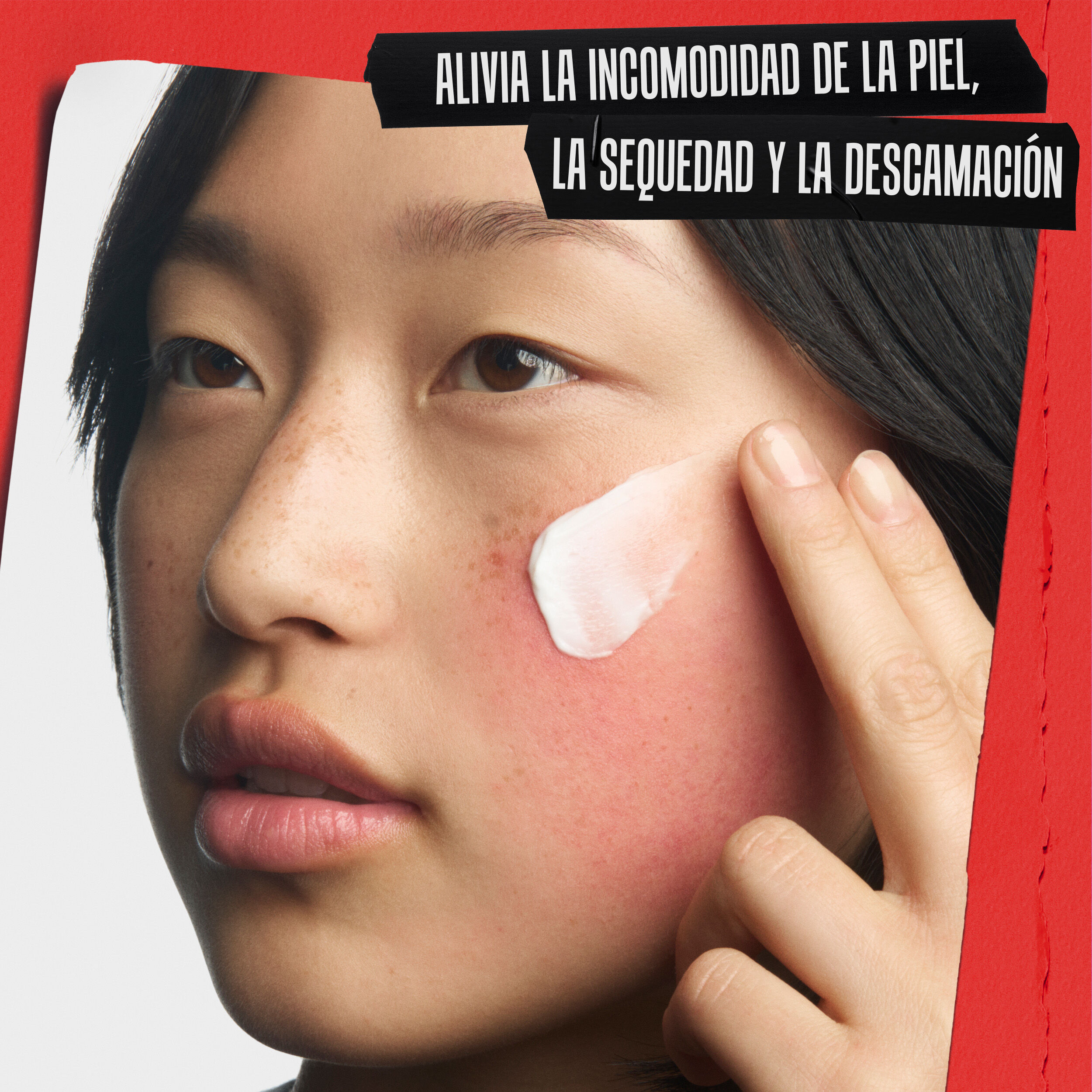 Primer plano de la crema recuperadora aplicada en una mejilla irritada. El texto dice: ALIVIA EL MALESTAR, LA SEQUEDAD Y LA DESCAMACION DE LA PIEL.