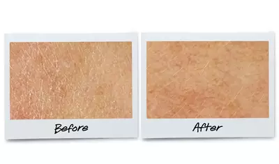 Before and after