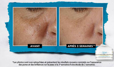 Kiehl's X Made by Radio