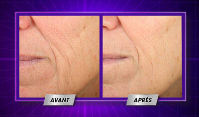 Kiehl's X Made by Radio