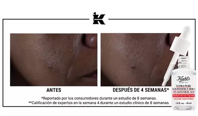 Before and After Retinol Serum