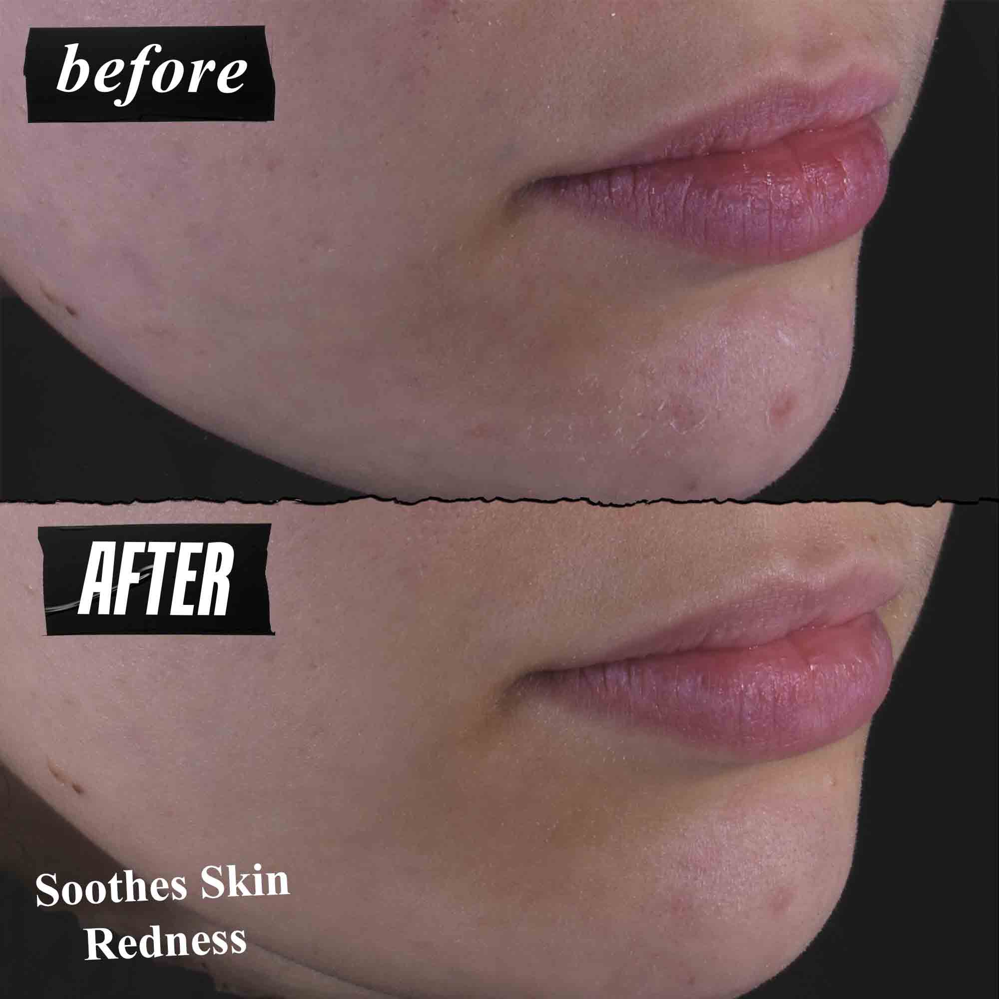 Calendula Herbal Extract Toner before & after on skin